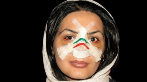 photo_5782891839219681229_x